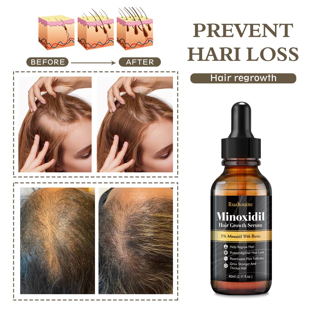 5% Minoxidil Hair Growth Serum Oil 2.11oz H81538