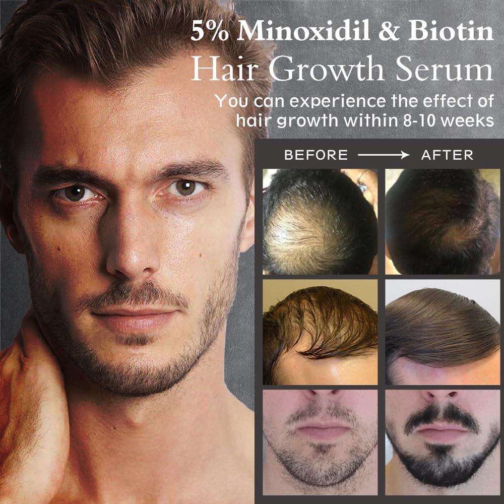 5% Minoxidil Hair Growth Serum Oil 2.11oz H81538